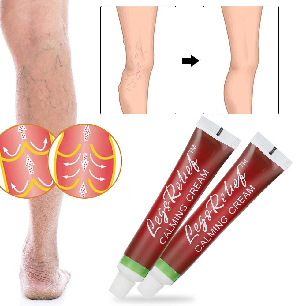 

2Types Varicose Vein Treatment Cream Phlebitis Vasculitis Thigh Spider Removal Reduce Swelling Pain Relief Medical Plaster Care