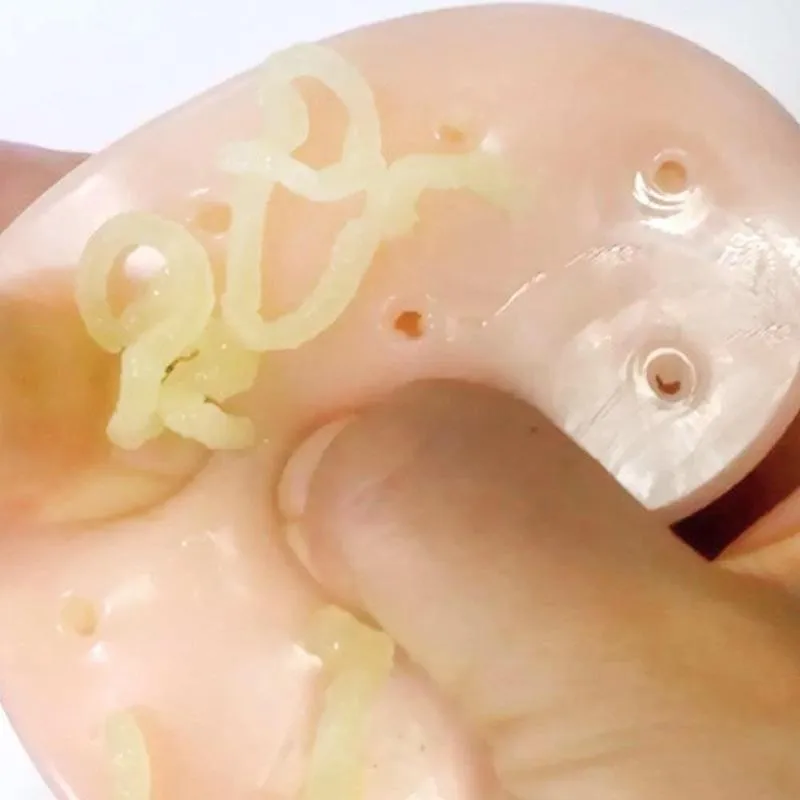 Приколы для удаления прыщей Новинка приколы розыгрыши игрушки смешное прикол