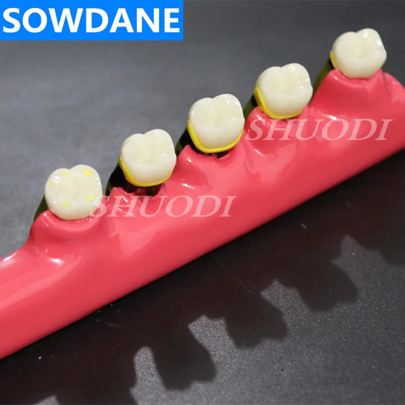 Стоматологическая модель зубов заболеваний пародонта разбирают зуб