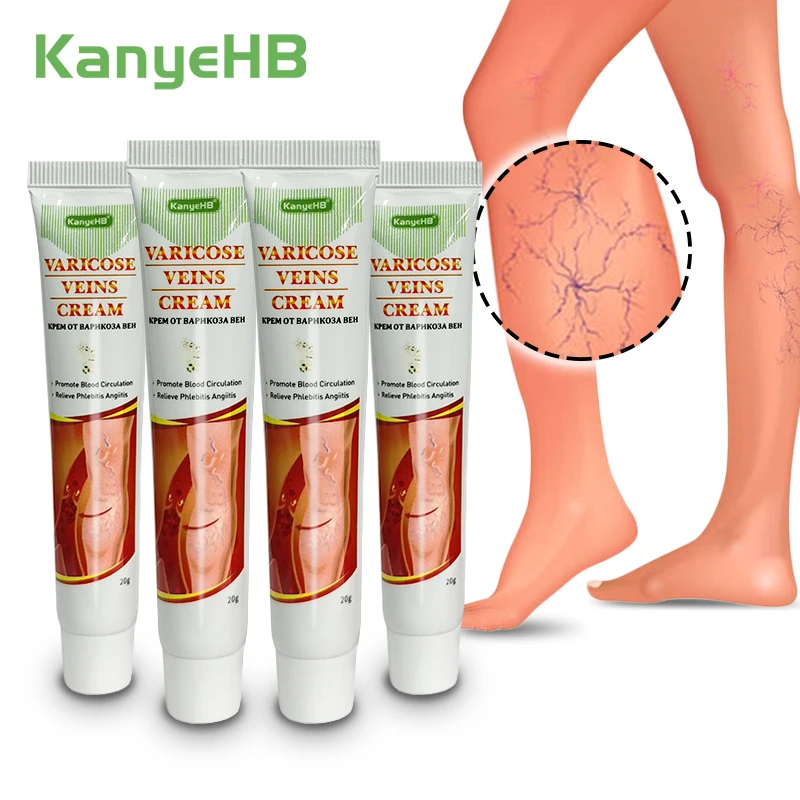 

4pcs New Arrivals Varicosity Cream Natural Herbs Remove Feet Varicose Veins Ointment Effective Treatment Leg Varices Cream A642