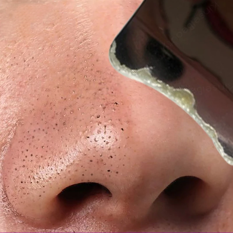 Ультразвуковой скруббер для кожи лица Вибрационный очищающий пилинг Лопата