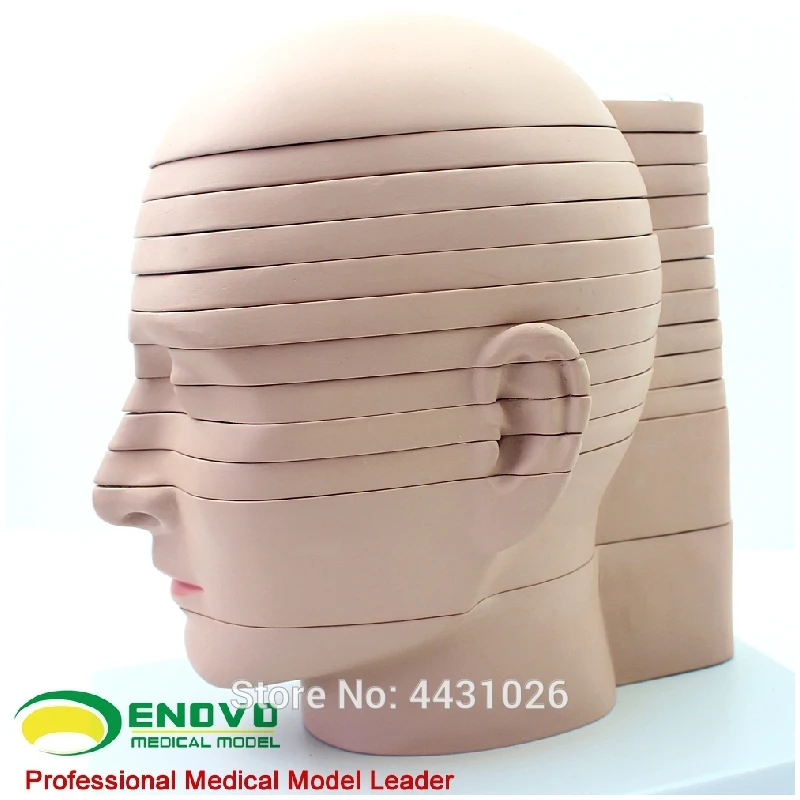 Эново мозговая транссекция модель для медицинского мозга КТ mrт магнитно