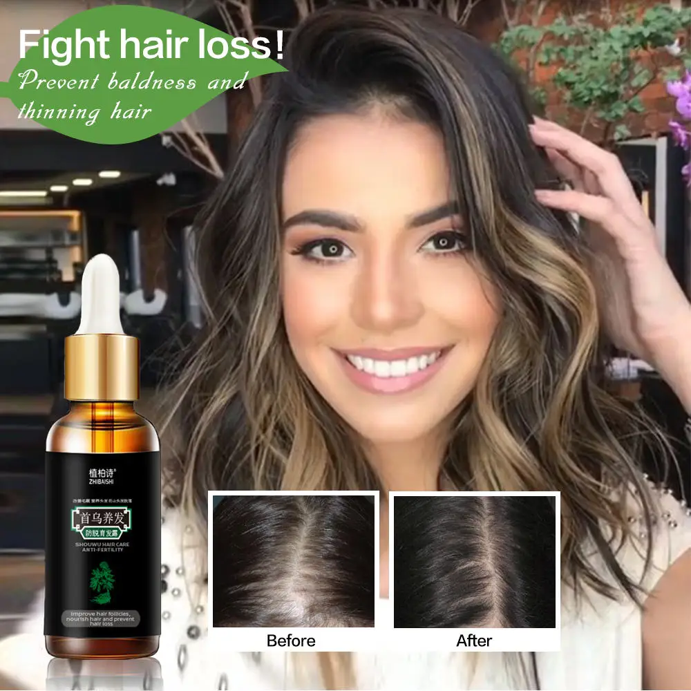 Средство для ухода за волосами против выпадения волос|Средства от волос| |