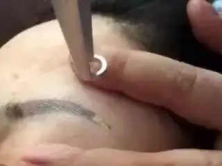 

Q-switch Nd Yag лазерная машина для удаления шрамов и татуировок, цена на удаление татуировок