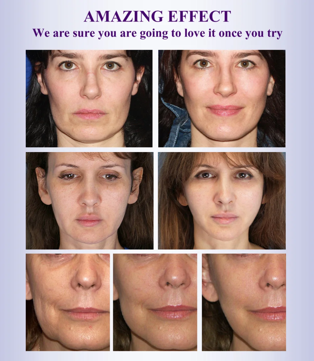 Эфирные масла быстрая зарядка для лица масляный массаж против морщин старения