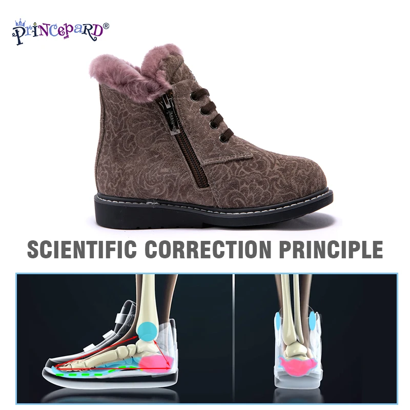 Princepard/зимняя ортопедическая обувь из 100% натурального меха для девочек и