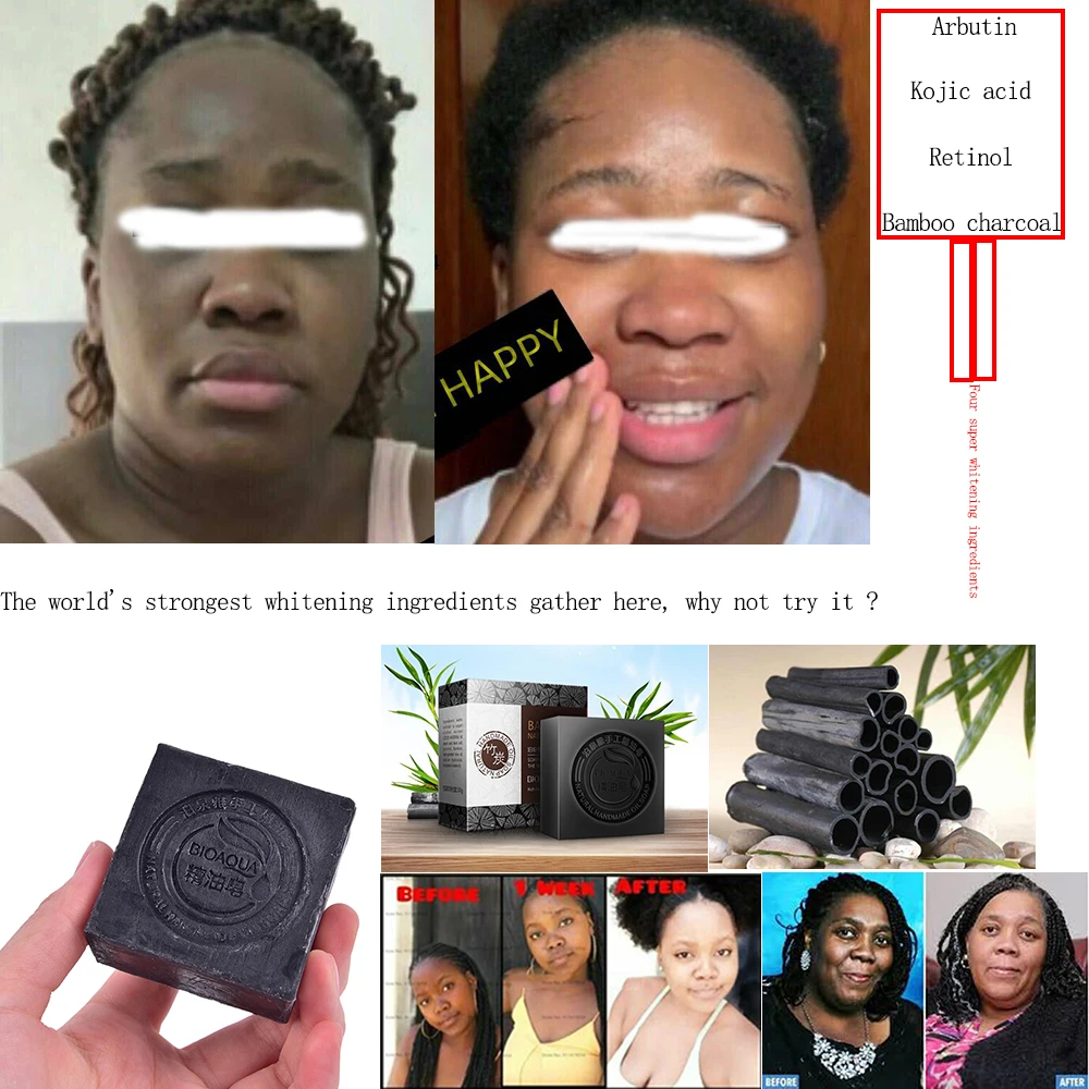 

Four Super Whitening Ingredients Bleaching Soap for Dark Skin with Arbutin Kojic Acid Retinol Permanent Brightening