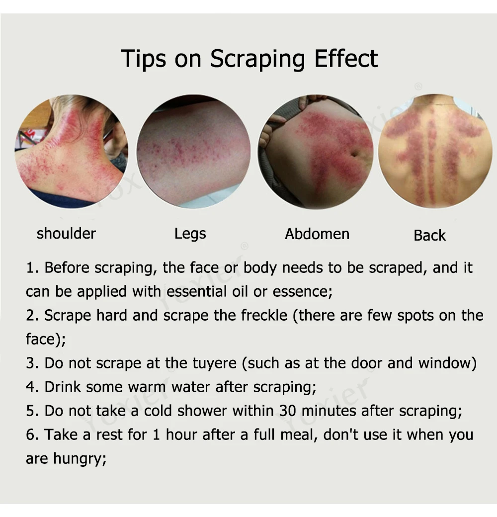 Yoxier Gua Sha Scraping Massage Tool Body Facial Eye Scraping Plate Acupuncture Massage Relaxation Health Care 1Pcs