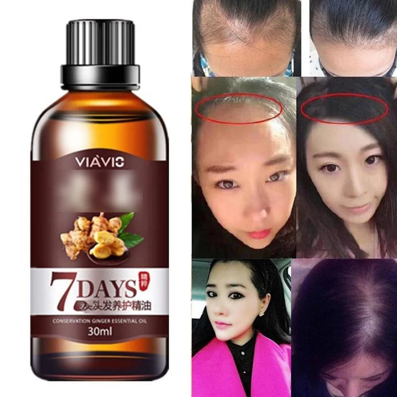 

7 days Ginger Hair Oil Hairs Essential Oils Hair Growth Serum Effective Hair Loss Treatment Regrowth Ginger Serum 30ml