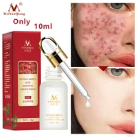 acne treatment face serum centella asiatica oil control shrink pores scar essence whitening moisturizer skin care meiyanqiong