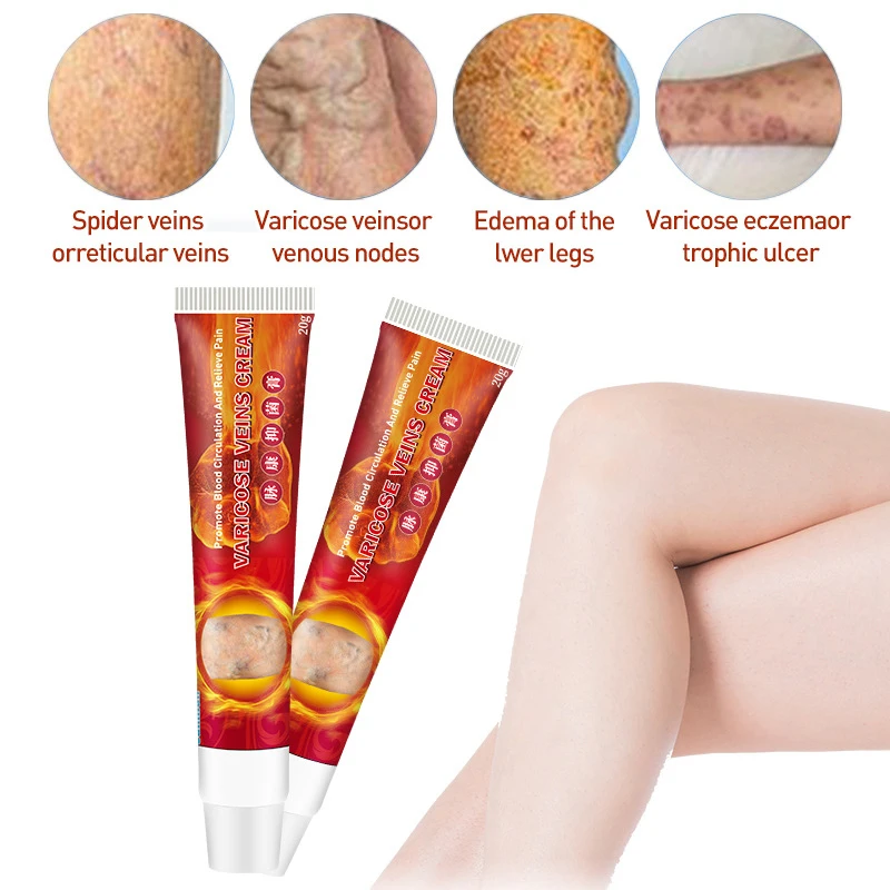 

2021 Varicose Veins Cream Relief Phlebitis Angiitis Remedy Pain Relief Cream for Spider Veins Edema Nerve Pain Leg Pain