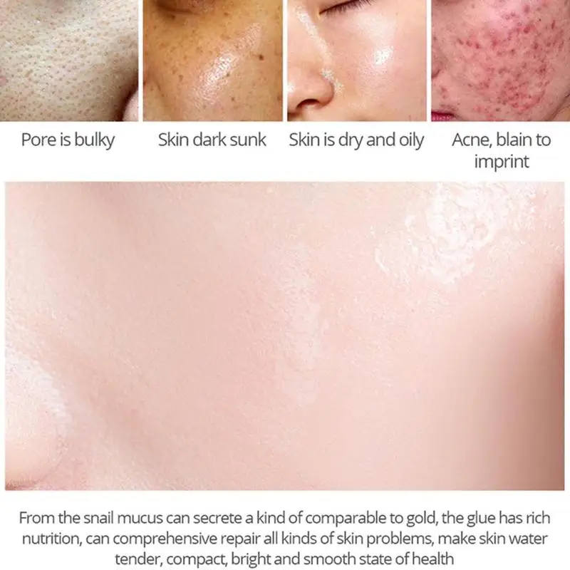 

Hyaluronic Acid Face Serum Shrink Pores Moisturizing Whitening Essence Acne Dry Rough Men Women Skin Care