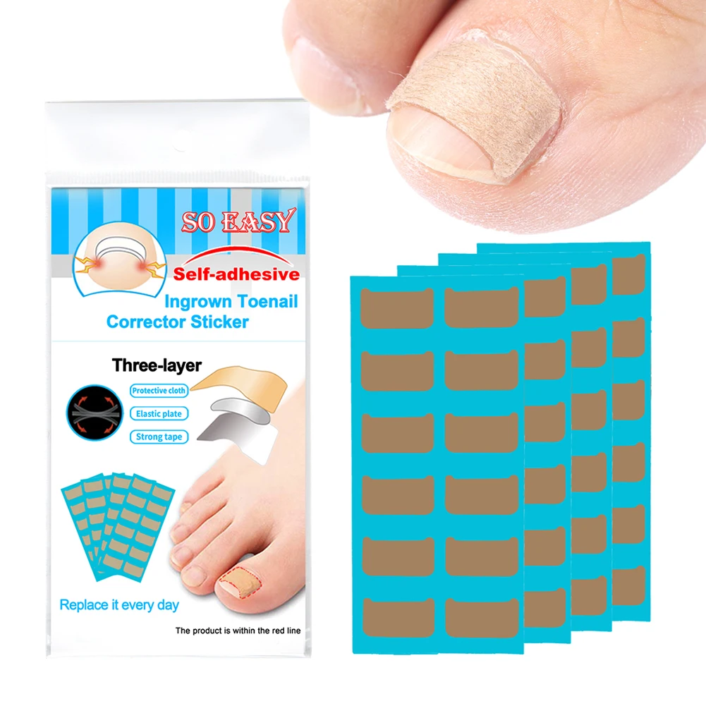 

36 Stickers Ingrown Toenail Corrector Sticker Paronychia Recover Nail Corrector Treatment Recover Patches Nail Care Tool