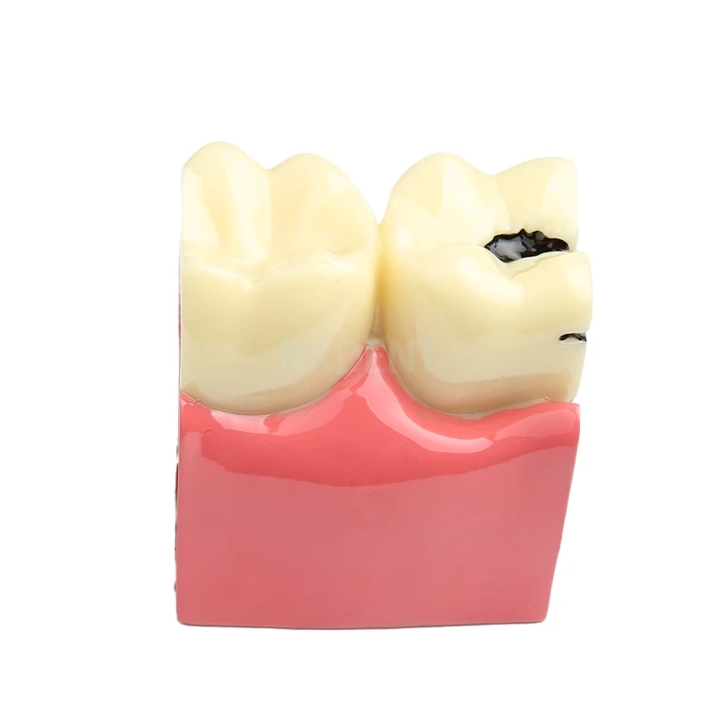 1 шт. карниз для зубов | Красота и здоровье