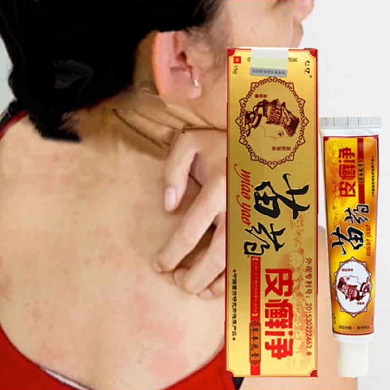 Новинка эффективный уход за кожей 15 г травяная мазь псориаз дерматит экзема зуд