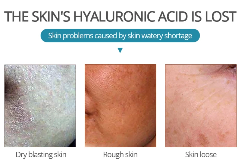 Hotsale Strong Hyaluronic Acid Serum Anti Wrinkle Moisturizing Whitening Essence Face Serums Beauty Care Health skin | Красота и