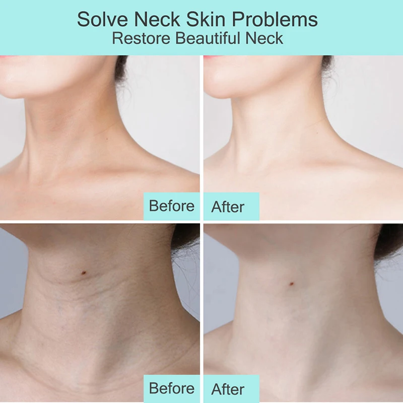 Витамин С + Е увлажняющий Сужающий поры питательный крем для шеи мягкий