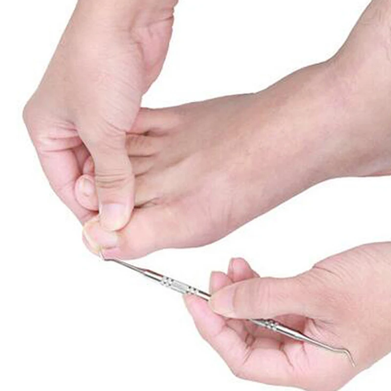 4 шт. Уход за ногтями на ногах инструменты файл для ног ортезический акрооникс