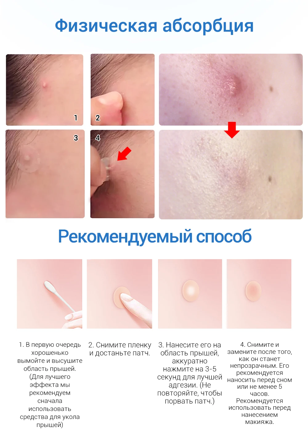 LANBENA маска для лица, лечение акне, маска для лица, уход за кожей, средство для удаления прыщей, патчи, наклейки, черная маска, пилинг, маски для лица