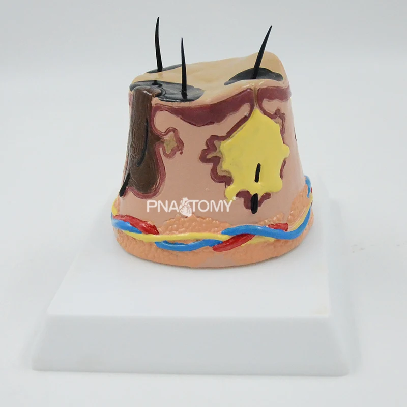 

Diseased Skin Model Human Skin Ache Anatomy Hair Anatomical Tool Medical Gift Educational Equipment Teaching Resources Enlarged
