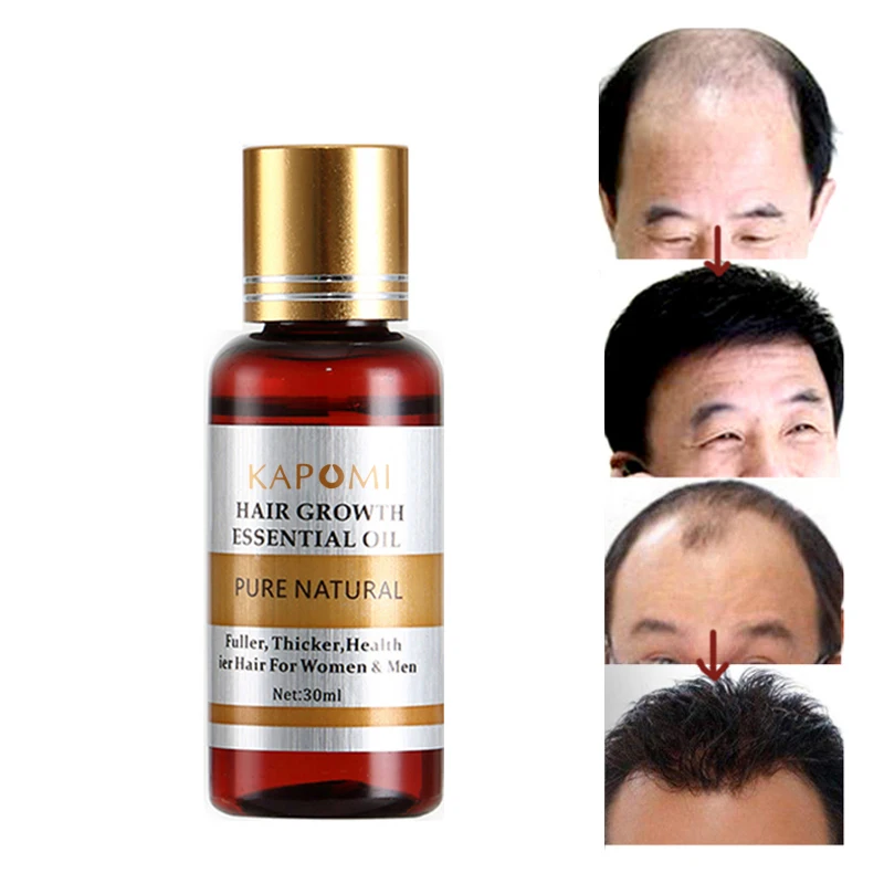 

Hair Care Hair Growth Essential Oils Essence 100% Hair Loss Liquid Health Care Beauty Dense Hair Growth Serum Oil Care Of Hair