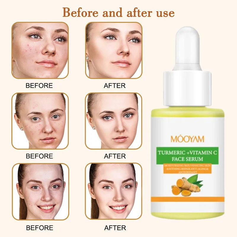 Масло куркумы способствует сиянию кожи выцветает темные патчи удаляет акне