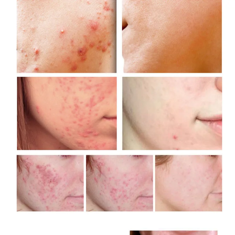 

Skin Care