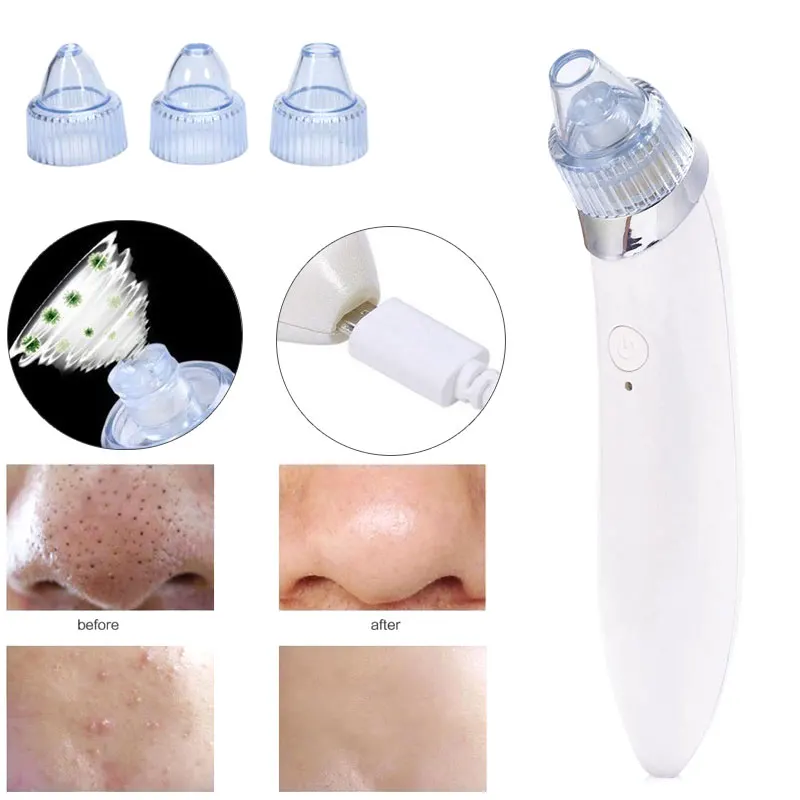 Уход за кожей угрей Удаление прыщей вакуумный всасывающий инструмент аппарат