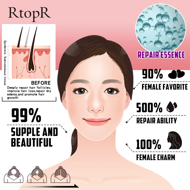 20 мл эфирное масло растительный рост волос от выпадения жидкость способствует