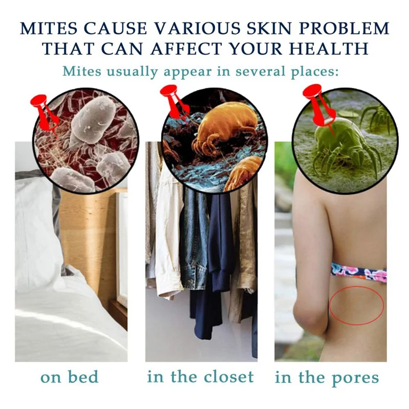 Эффективное восстанавливающее клещи питает кожу лица очищающее мыло против