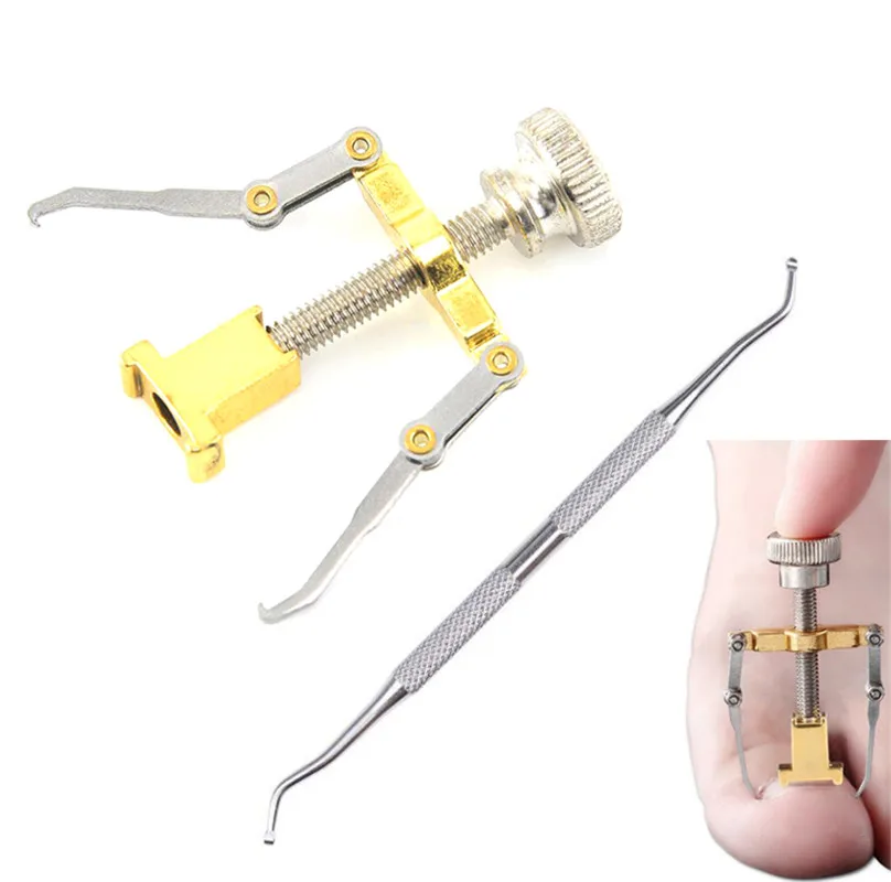 Вросшие ногти палец ноги коррекция ногтей крепёжные приспособления для педикюра