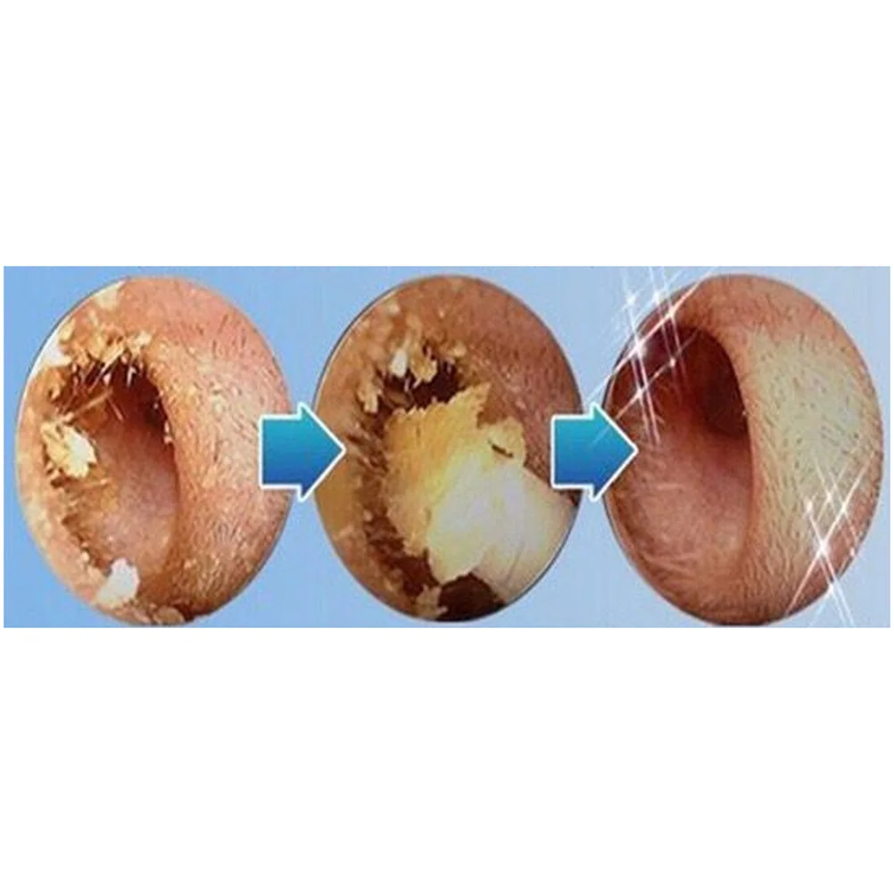 Средство для чистки ушей мягкий спиральный очиститель предотвращение удаления
