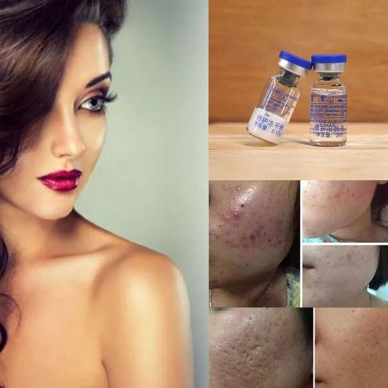 Oligopeptide Freeze-dried Mask Epidermal Growth Factor Pimples Scars Care Acne Serum Treatment Skin Wrinkles Powder S8C4