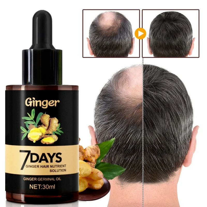 

30ML Hair Growth Products 7 Days Growing Hair Oil Anti Hair Loss Liquid Beauty Hair & Scalp Treatment Hair Growth Serum Essence