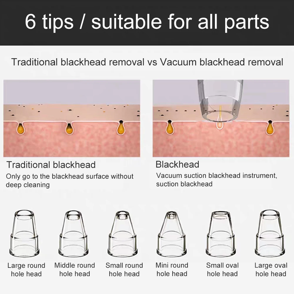USB устройство для удаления угрей вакуумные всасывающие Патчи от акне стикер