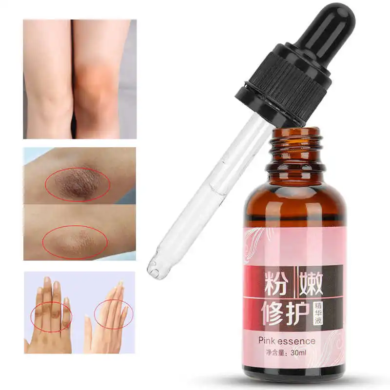 

30ml Skin Whitening Serum Natural Underarm Whitening Cream for Armpit Knees Elbows Private Part Skin Care for Women