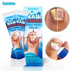 Восстанавливающий Антибактериальный крем для ногтей, 1 шт., 20 г
