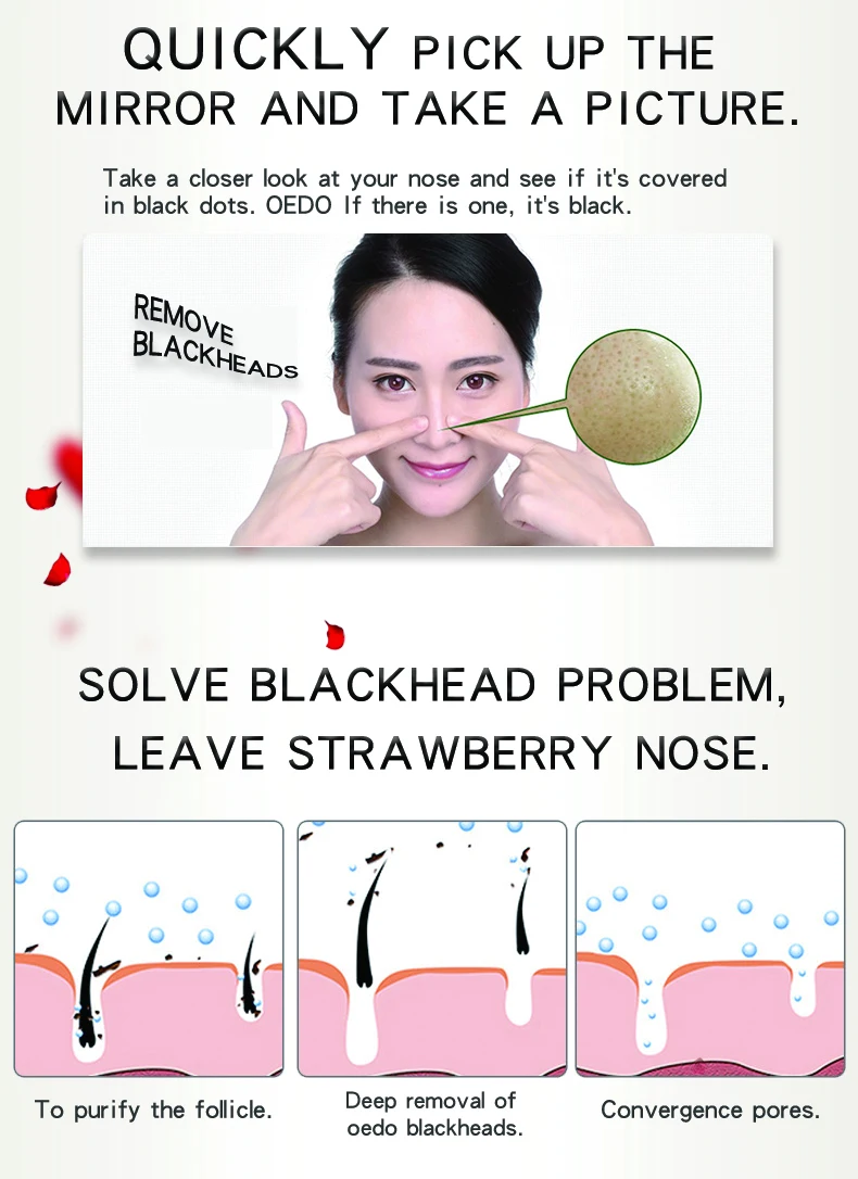 10PCSRose Peptides маска для удаления угрей маска для носа лечение пор черная маска пилинг черная голова чистая для ухода за кожей лица Mas