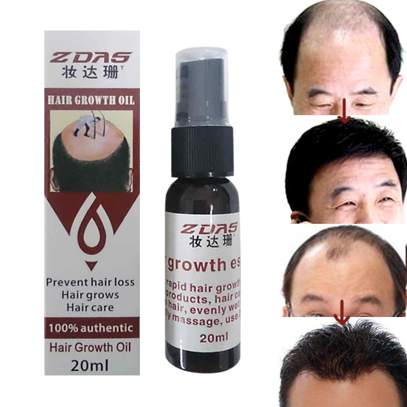 Эффективная эссенция для роста волос масло филировка продукты против выпадения