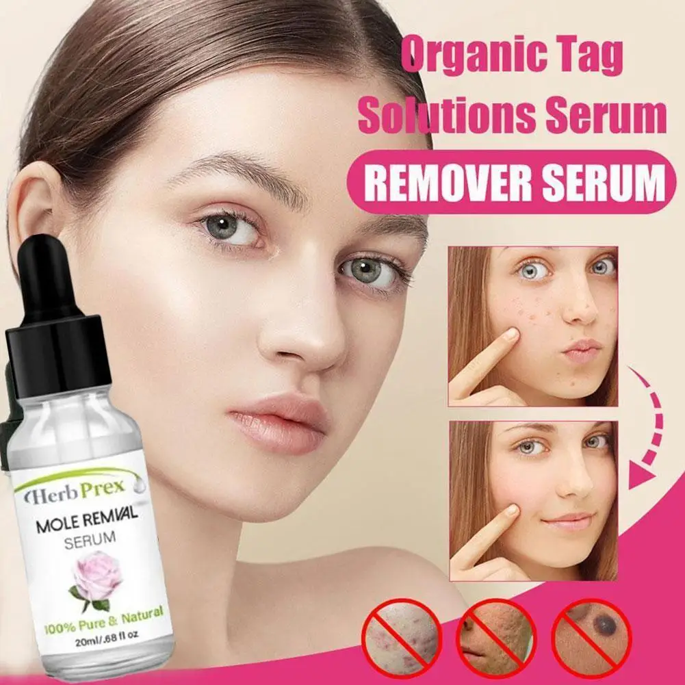 

20ML Liquid Wart Mole Removal Serum Organic Tags Solutions Serum Skin Tag Mole Freckle Spot Fast Remover Essence Skin Care