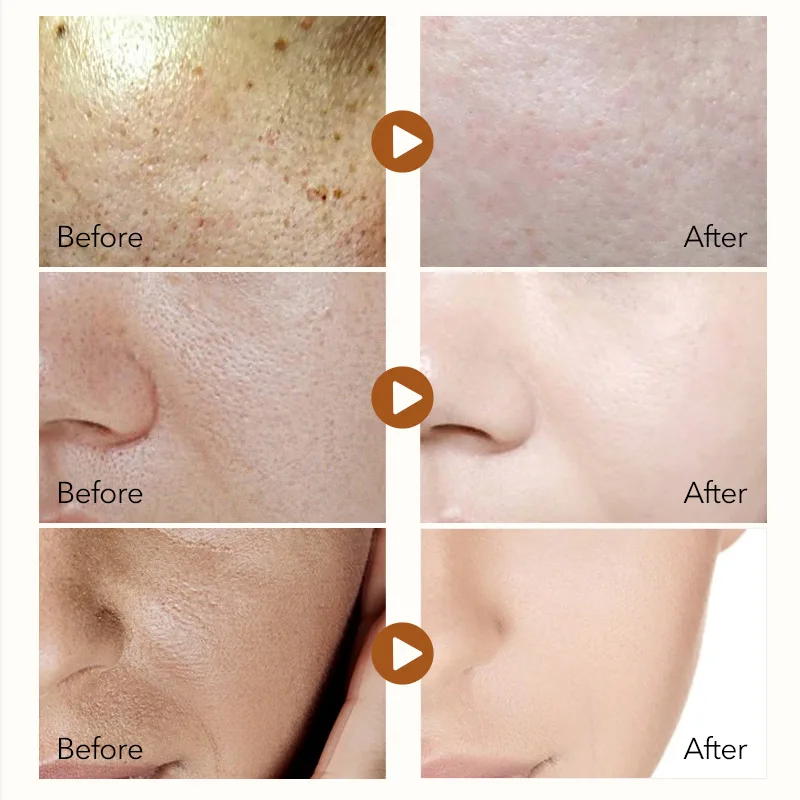 30 мл гиалуроновая кислота Усадочные поры лица сыворотка против старения