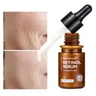 Увлажняющая отбеливающая Сыворотка для лица, против морщин