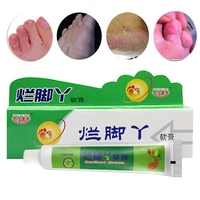 athletes foot ointment foot odor stinky sweat anti itch peeling foot repair cream anti fungal medicine ringworm foot care