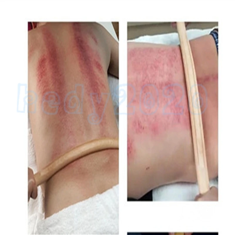 

50pcs Scraping sticks for the whole body General beauty rolling sticks Scraping sticks for health Meridian dredge the sticks