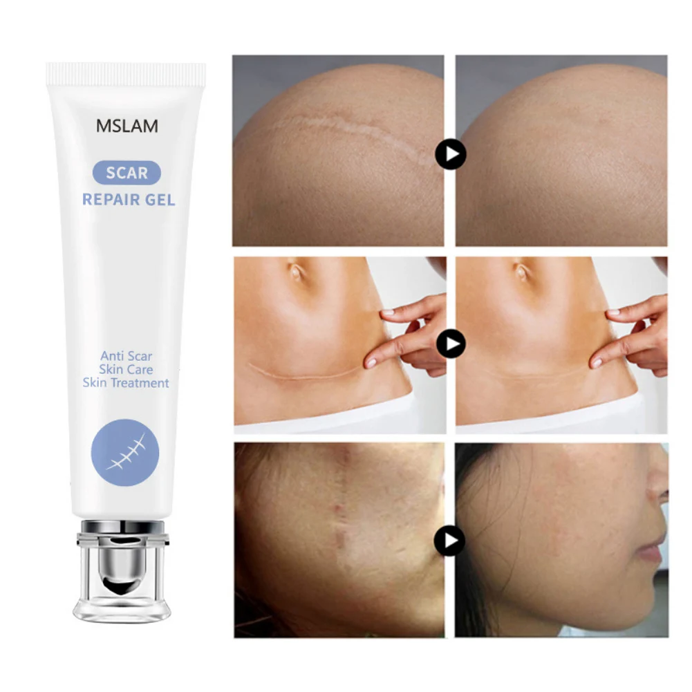 20g Body Scrubs Scar Removal Cream Skin Trauma Surgery Repair Acne Essence Gel Care Products |