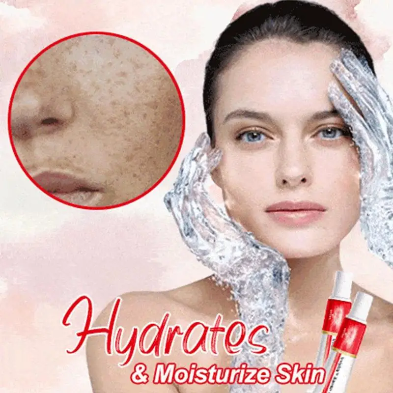 Whitening Freckle Cream Removal Melasma Acne Scar Pigment Melanin Sun Spots Face Care