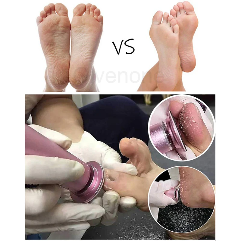 Электрическая пилка для ног инструменты педикюра средство удаления огрубевшей