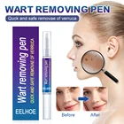 Этикетки для кожи, натуральные ингредиенты, безопасное и мягкое удаление бородавок, мозолей, этикетки для мужчин, женщин и мужчин