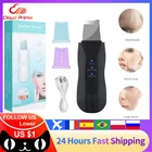 Скребок для кожи, глубокий вибрирующий очиститель лица, лопатка, лопатка, не ультразвуковой скребок для лица, пилинг, удаление черных точек, подъемный массажер