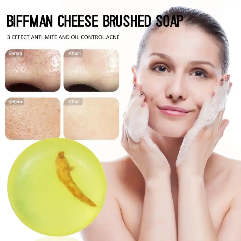 Сетка против клещей питающее кожу от акне матиновое мыло контроль жирности